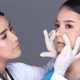 rhinoplasty