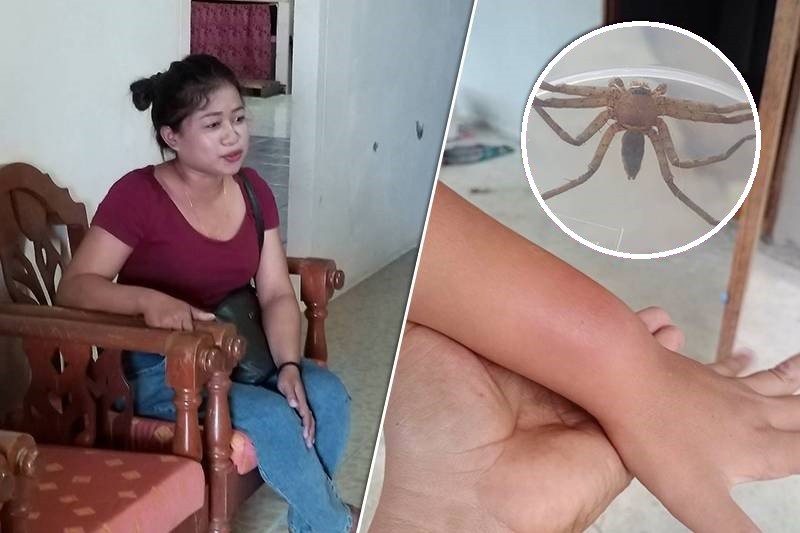 Bitten , Venomous Spider, brown recluse spider, Thailand