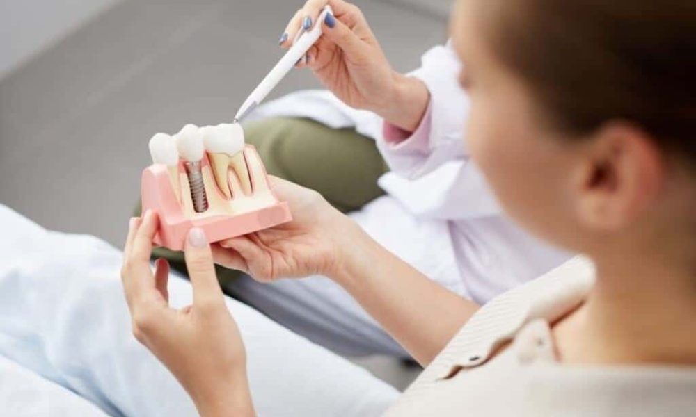 How to Find Affordable Dental Implants