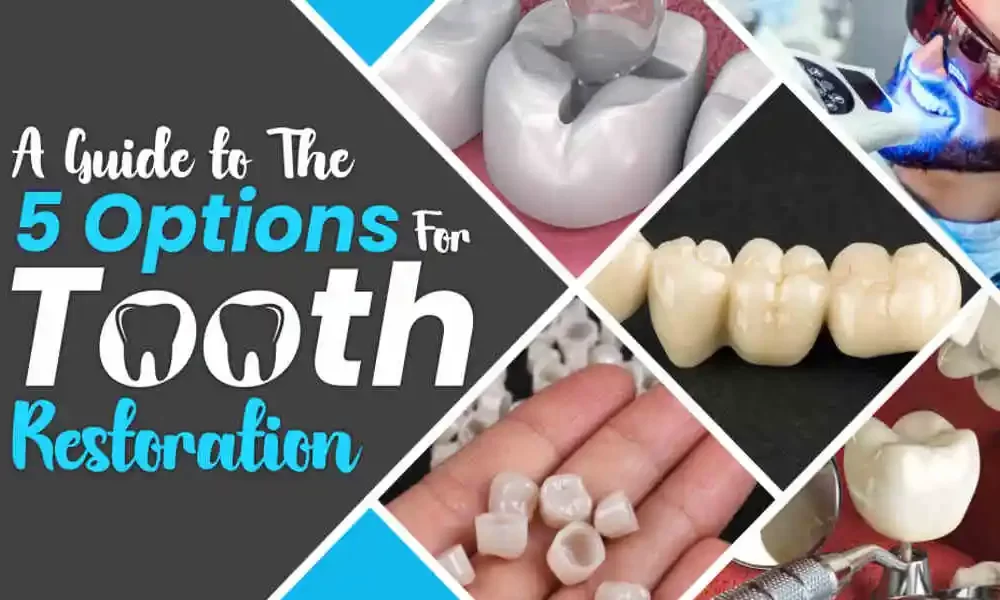 Tooth restorations