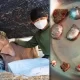 Vets in Thailand Remove 14 Bullets from Baby Elephant