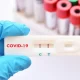 Free COVID Test Kit