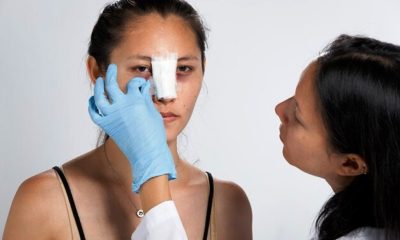 rhinoplasty before and after