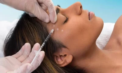 Botox Lip Flip