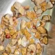 Indian Doctors Remove 206 Kidney Stones In 1 Hour From A 56-Year-Old Man