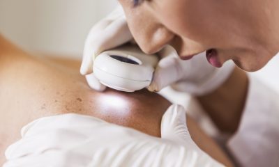 Skin Checkup