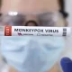 Thailand's Second Monkeypox Case Found In Bangkok