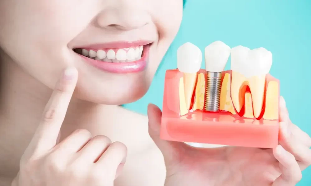 How To Protect Dental Implants So They Last Forever