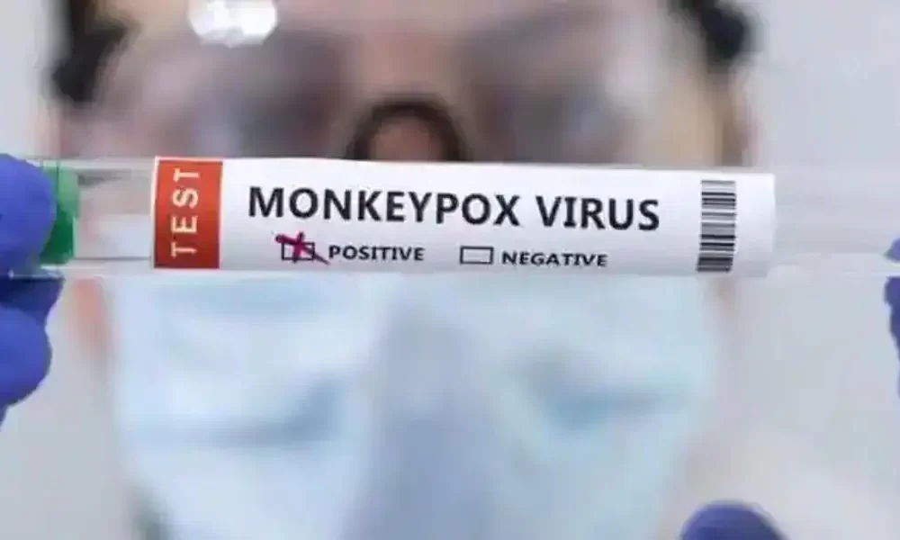 Monkeypox Is Retreating, But The Threat Still Exists, According To Experts