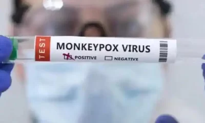 Monkeypox Is Retreating, But The Threat Still Exists, According To Experts