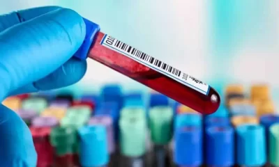 Vitamin D Deficiency And Mortality: Genetic Evidence