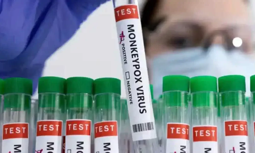 According To WHO, Monkeypox Will Be Renamed MPOX