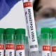 According To WHO, Monkeypox Will Be Renamed MPOX