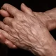 Why are Blood Vessels Flowing From his Hands?