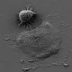 In a Skin Cancer Model, Artificial Skin Blocks Invasive Growth