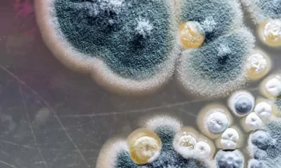 Deadly Fungus Candida Auris Spreading Rapidly in US, CDC Warns