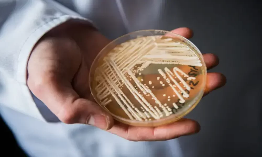 What You Need to Know about Candida auris, its Symptoms and Spread in Hospitals