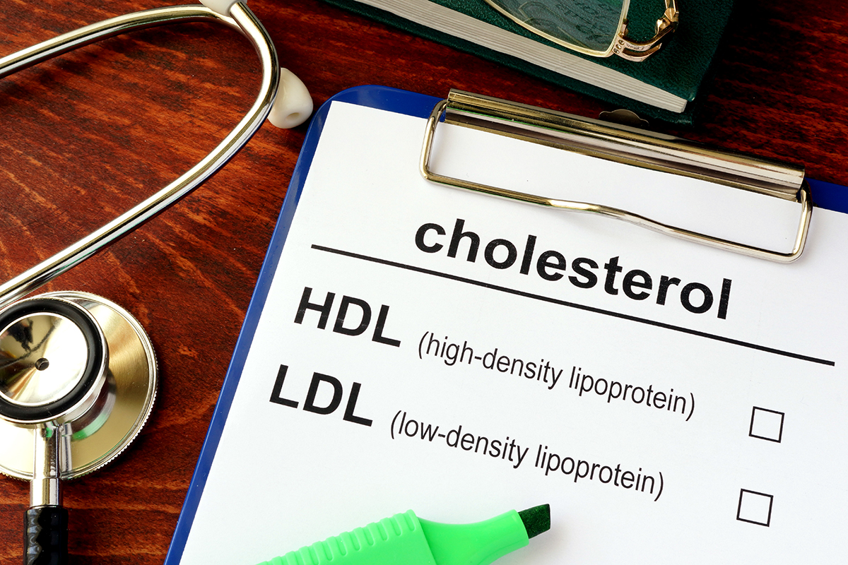 Cholesterol Test