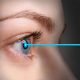laser eye surgery