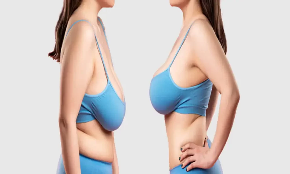 The Complete Guide To Breast Plastic Surgery Procedures