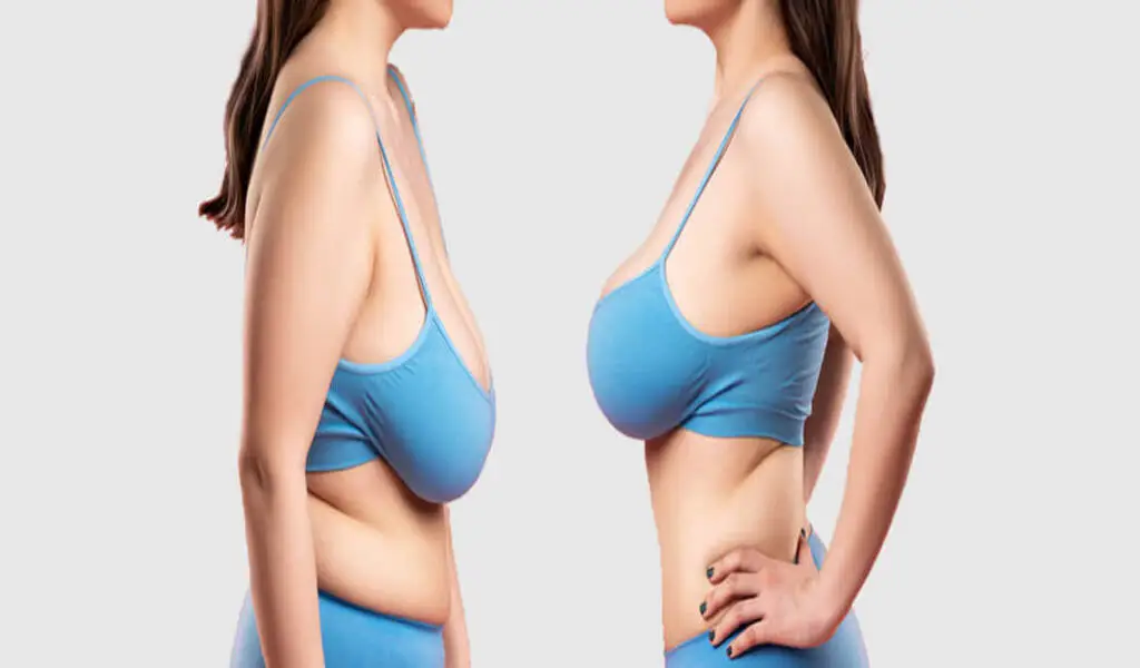 The Complete Guide To Breast Plastic Surgery Procedures