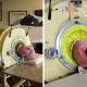 Paul Alexander, a polio Survivor who lived inside an Iron Lung for 72 Years, has Died