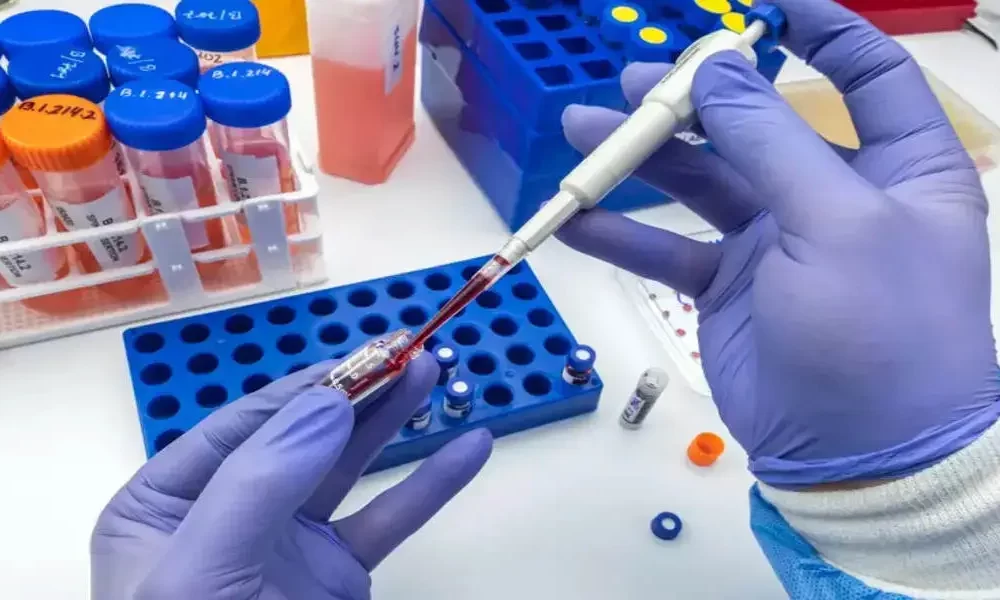 Study: Colorectal Cancer Blood Test Could Be Approved In 2024