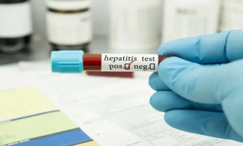 Hepatitis E