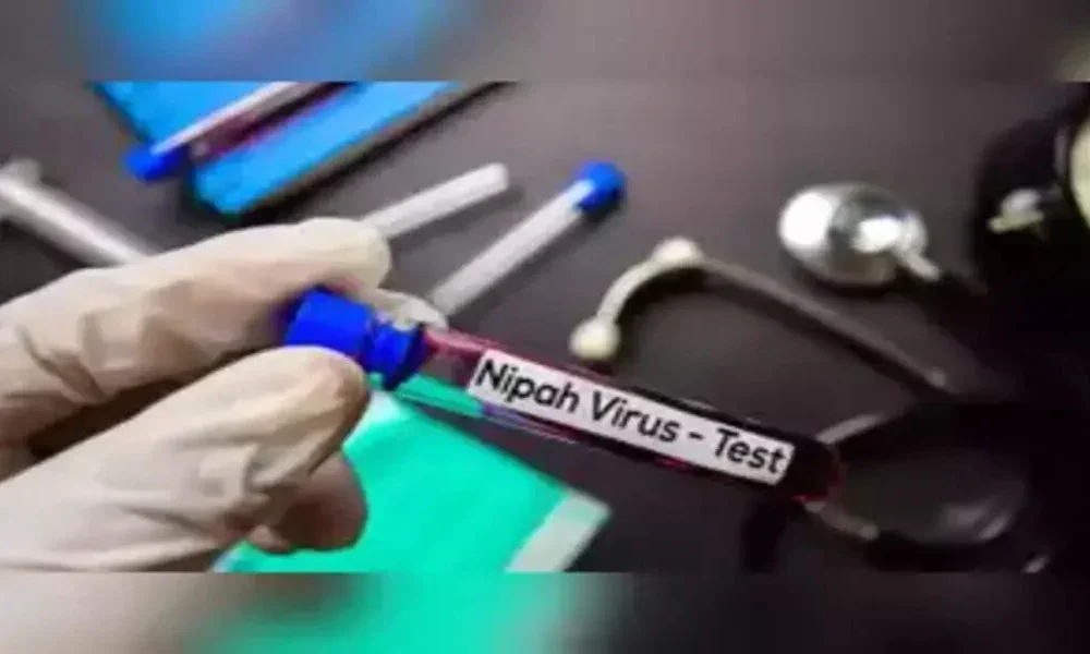 Nipah Virus